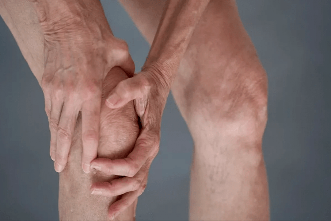 Joint pain can be the cause of dry joints or arthritis
