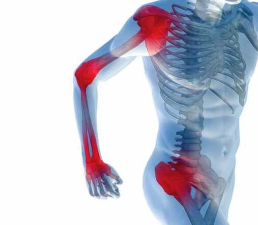 Joint pain - joint pain