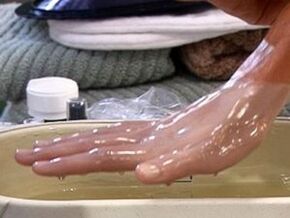 Paraffin therapy for arthritis