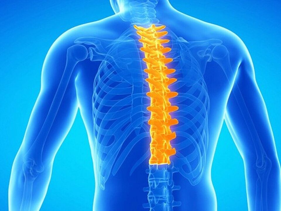 Injury to the thoracic spine in osteonecrosis disease