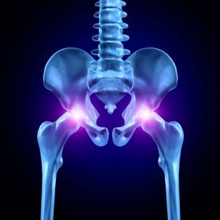 Hip pain can be acute, painful or chronic