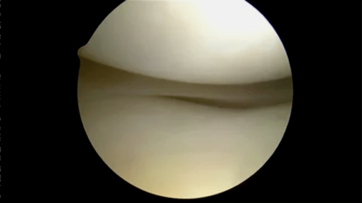 Telescopic observations of perfectly healthy surfaces