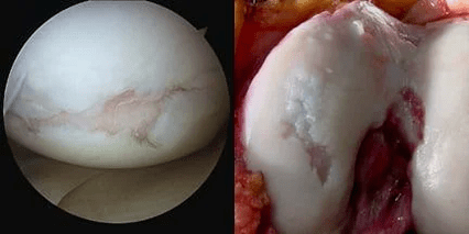 image of the knee joint surface