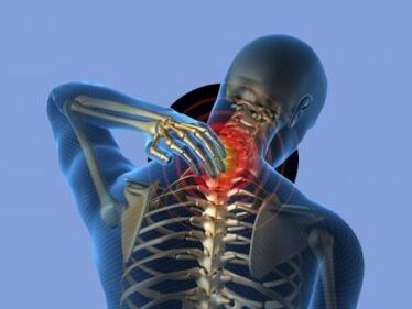 People with cervical spondylosis will experience neck pain