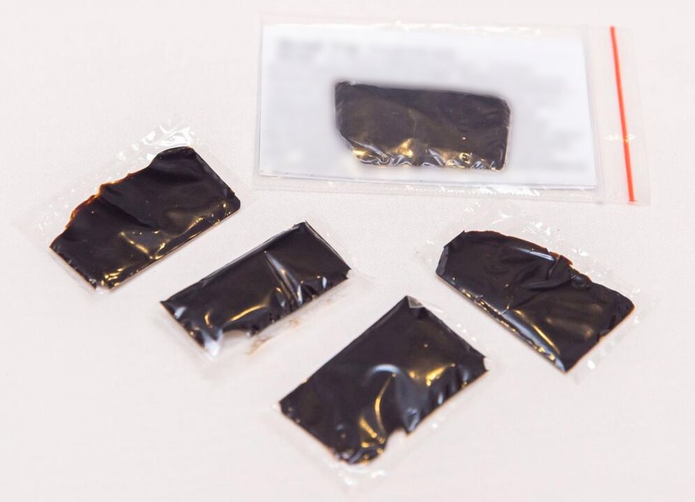 Shilajit is an effective home remedy for cervical spondylosis